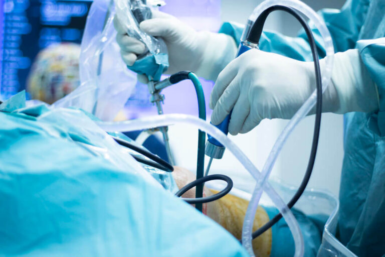 Best Arthroscopy Surgeon for Knee and Shoulder in Ahmedabad