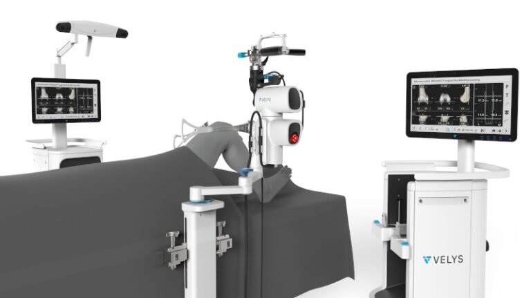 Best robotic knee replacement surgeon in Ahmedabad